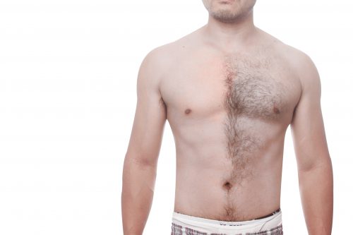 Brazilian Wax Mannen